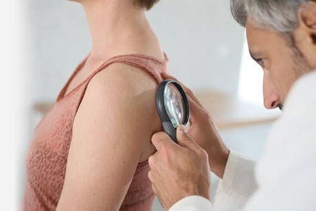 Dermatologist examining a woman's skin during a skin cancer screening